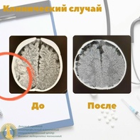 

Чудо под Новый год: история спасения маленького пациента image

