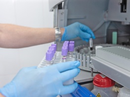 

О мерах профилактики при оспе обезьян image
