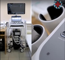 

В поликлинику № 76 Калининского района поступило новое диагностическое оборудование image
